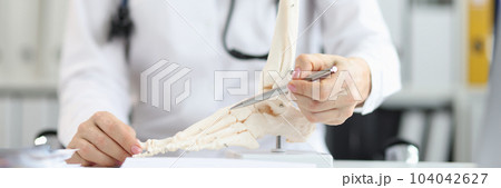 Orthopedic doctor explains physiology of bone model by pointing to point of model Orthopedic doctor explains physiology of bone model by pointing to point of model 104042627