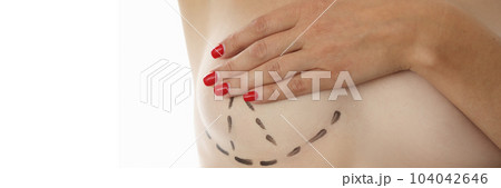 Breast correction and plastic surgery and small female breasts Breast correction and plastic surgery and small female breasts 104042646