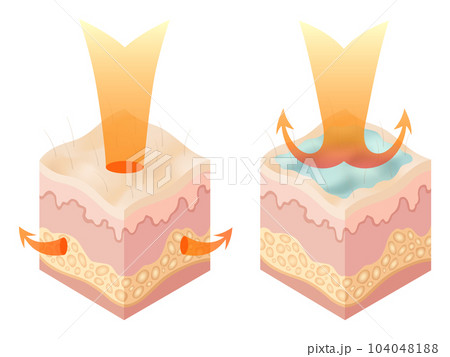 Protection uv ray skin. Illustration about Skin care concept. Sun protection body adipose layers epidermis, vector infographic 104048188