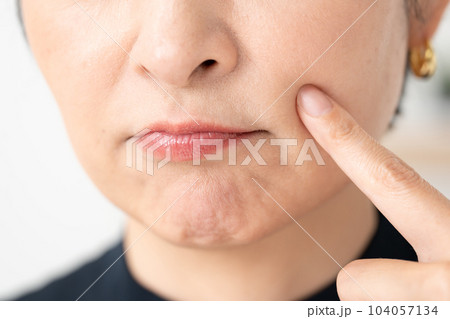 ほうれい線を気にする女性 ほうれい線を気にする女性 104057134