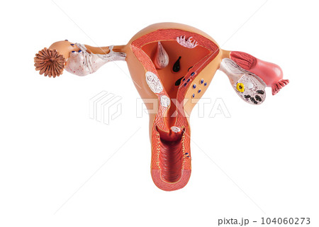 Uterus model isolated on white background with clipping path, doctor holding anatomy model for study diagnosis and treatment in hospital. Uterus model isolated on white background with clipping path, doctor holding anatomy model for study diagnosis and treatment in hospital. 104060273