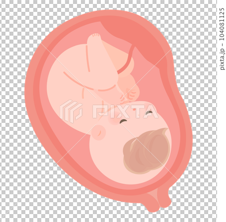 Fetus in the womb Normal baby Fetus in the womb Normal baby 104081125