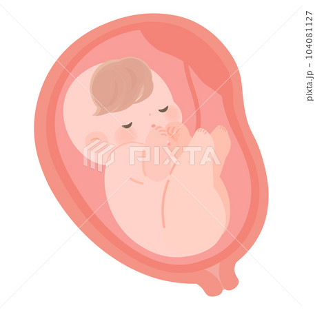 逆子で単殿位の赤ちゃんの子宮内イラスト 104081127