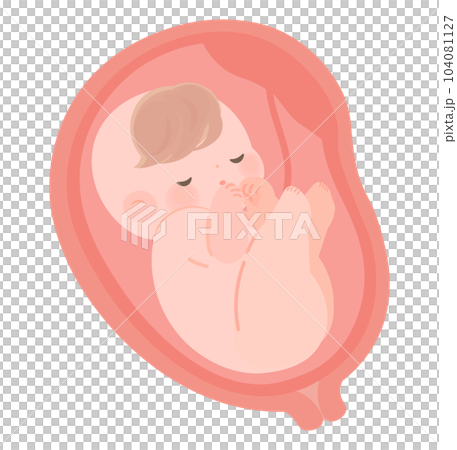 逆子で単殿位の赤ちゃんの子宮内イラスト 104081127