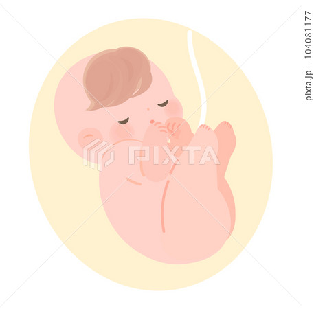 逆子で単殿位の赤ちゃんの胎内イメージ　へその緒あり 104081177