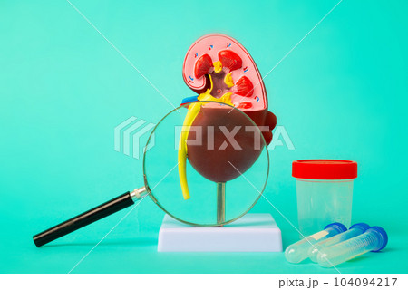 Anatomical model of human kidney with magnifying glass and test tubes and jar for analysis on blue background. Early diagnosis and treatment. Anatomical model of human kidney with magnifying glass and test tubes and jar for analysis on blue background. Early diagnosis and treatment. 104094217