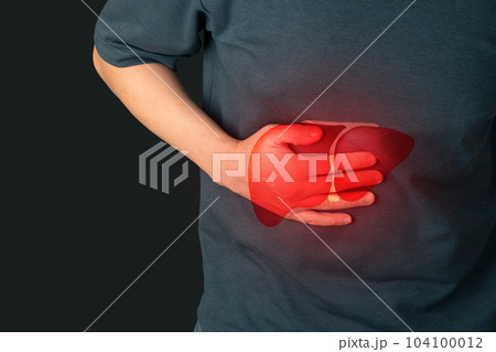World hepatitis day concept. Male suffering from abdominal pain with liver organ inflammation over black background. Causes of hepatitis include viral infection, alcohol, drugs or autoimmune. World hepatitis day concept. Male suffering from abdominal pain with liver organ inflammation over black background. Causes of hepatitis include viral infection, alcohol, drugs or autoimmune. 104100012