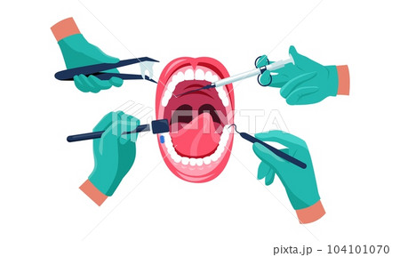 Dental treatment. Dentist hands in medical rubber gloves with instruments working on patient mouth, oral care concept. Vector cartoon illustration Dental treatment. Dentist hands in medical rubber gloves with instruments working on patient mouth, oral care concept. Vector cartoon illustration 104101070
