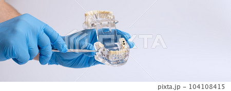 Dentist's hand in a blue glove holds a dental jaw model indicates a missing tooth Dentist's hand in a blue glove holds a dental jaw model indicates a missing tooth 104108415