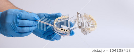 Dental technician holding a dental jaw model on a white background. Showing caries Dental technician holding a dental jaw model on a white background. Showing caries 104108418