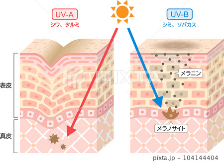 紫外線　UV-AとUV-Bの違い　肌の立体断面図　 104144404