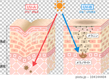 紫外線　UV-AとUV-Bの違い　肌の立体断面図　 104144404