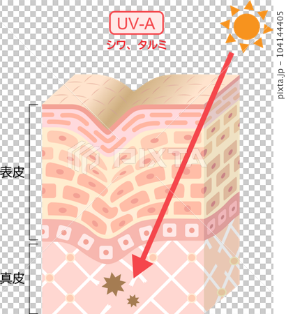 紫外線　UVA 　肌の立体断面図 104144405