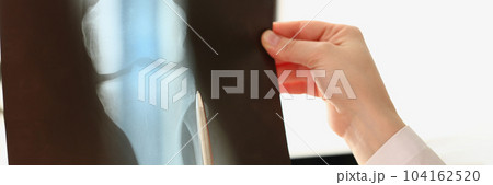 Female doctor looks at x-ray of knee injury in hospital Female doctor looks at x-ray of knee injury in hospital 104162520