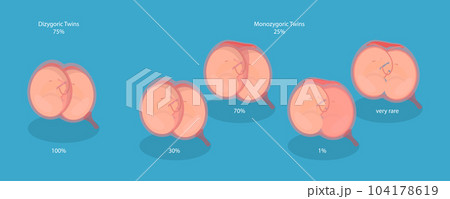 3D Isometric Flat Vector Conceptual Illustration of Embryo In Womb 104178619