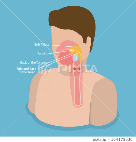 3D Isometric Flat Vector Conceptual Illustration of Oropharynx 104178636