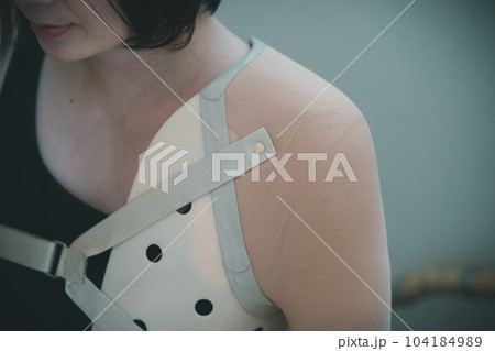 upper limb disability upper limb disability 104184989