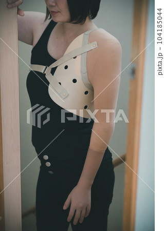 upper limb disability upper limb disability 104185044