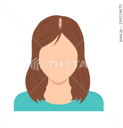 女性のびまん性脱毛症 ベクターイラスト (顔なし) 女性のびまん性脱毛症 ベクターイラスト (顔なし) 104229670