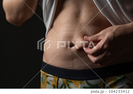 お腹の贅肉をつまむ男性　ダイエット 104233412