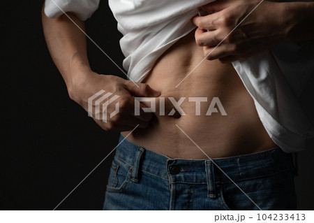 お腹の贅肉をつまむ男性　ダイエット 104233413