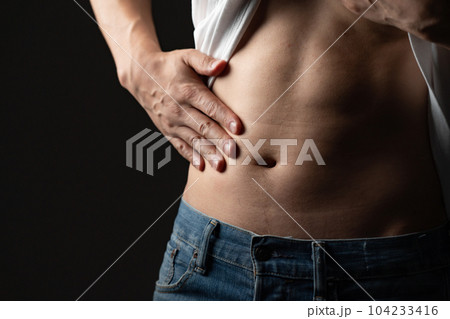 お腹の贅肉をつまむ男性　ダイエット 104233416