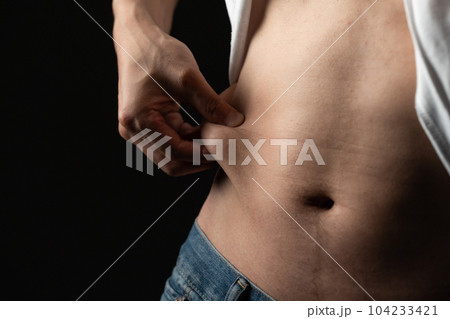 お腹の贅肉をつまむ男性 ダイエット お腹の贅肉をつまむ男性 ダイエット 104233421
