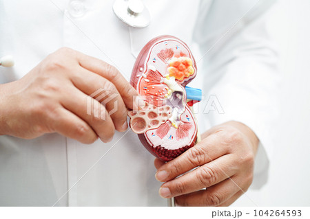 Chronic kidney disease, doctor holding model for treatment urinary system, urology, Estimated glomerular filtration rate eGFR. Chronic kidney disease, doctor holding model for treatment urinary system, urology, Estimated glomerular filtration rate eGFR. 104264593