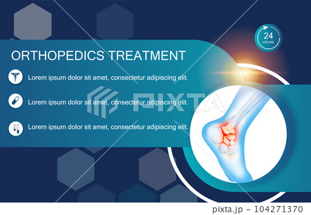Technology for treatment of ankle and foot bone injury. Abstract traumatology and orthopedics. Medical science in the hospital for body joints. 104271370