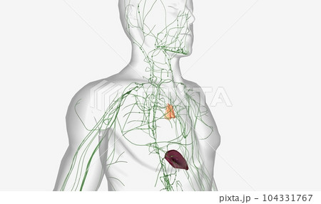 Non Hodgkin is Lymphoma in Lymph node 104331767