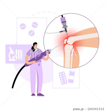 Knee joint arthroscopy 104341331