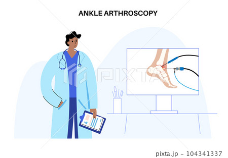 Ankle arthroscopy poster 104341337