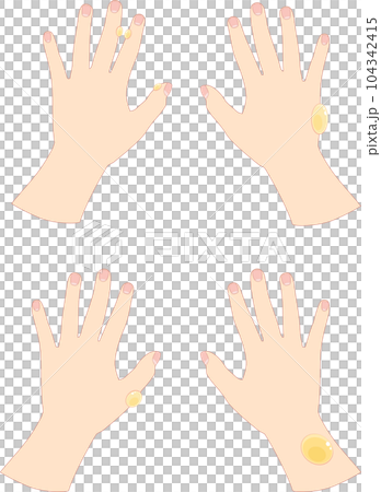 Female hand with blisters 1 104342415