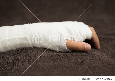 骨折や打撲、捻挫をして腕を固定するイメージ 骨折や打撲、捻挫をして腕を固定するイメージ 104353403