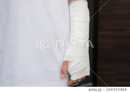 骨折や打撲、捻挫をして腕を固定するイメージ 骨折や打撲、捻挫をして腕を固定するイメージ 104353404