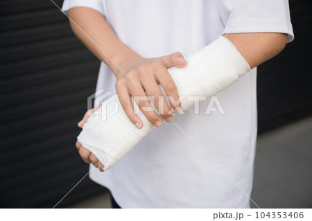 骨折や打撲、捻挫をして腕を固定するイメージ 104353406