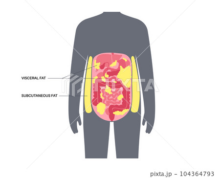 Visceral fat diagram 104364793
