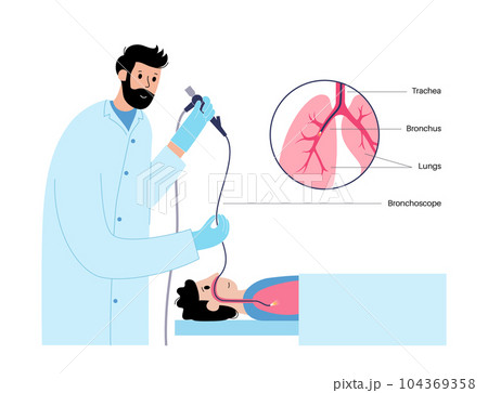 Bronchoscopy procedure concept Bronchoscopy procedure concept 104369358