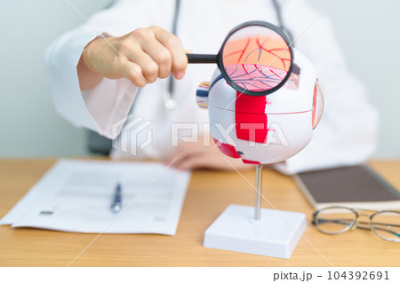 Doctor with human Eye anatomy model with magnifying glass. Eye disease, Refractive Errors, Age Related Macular Degeneration, Cataract, Diabetic Retinopathy, Glaucoma, Amblyopia, Strabismus and Health Doctor with human Eye anatomy model with magnifying glass. Eye disease, Refractive Errors, Age Related Macular Degeneration, Cataract, Diabetic Retinopathy, Glaucoma, Amblyopia, Strabismus and Health 104392691