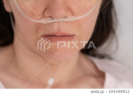 Portrait of a woman in a hospital bed with an oxygen mask. Unhealthy woman suffer from serious viral illness. Portrait of a woman in a hospital bed with an oxygen mask. Unhealthy woman suffer from serious viral illness. 104399912