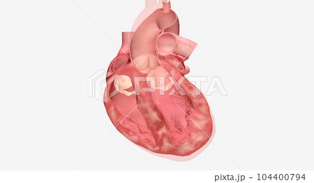The Heart is Failure Medications The Heart is Failure Medications 104400794