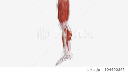 The calf muscles (gastrocnemius) are the most common area of a m 104400865