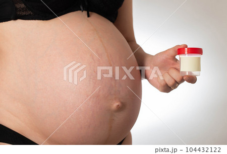 A pregnant girl holds a jar in her hand for collecting urine tests. Koznept urinalysis during pregnancy, protein and acetone in the urine. Research on genital infections, bacteria and preeclampsia. A pregnant girl holds a jar in her hand for collecting urine tests. Koznept urinalysis during pregnancy, protein and acetone in the urine. Research on genital infections, bacteria and preeclampsia. 104432122