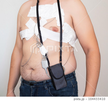 Cardiological procedure for the study of the heart Holter monitoring. Identification of heart diseases, blood supply and disorders of the heart, heart failure. Cardiological procedure for the study of the heart Holter monitoring. Identification of heart diseases, blood supply and disorders of the heart, heart failure. 104433410