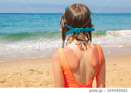 Child with sunburned skin at a beach Child with sunburned skin at a beach 104440082