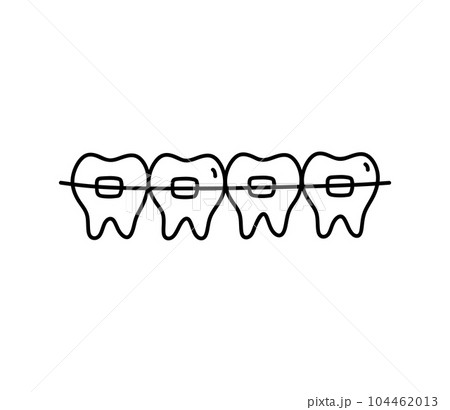Braces on teeth isolated on white background 104462013