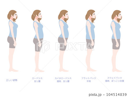 横から見た不良姿勢の女性セット 104514839