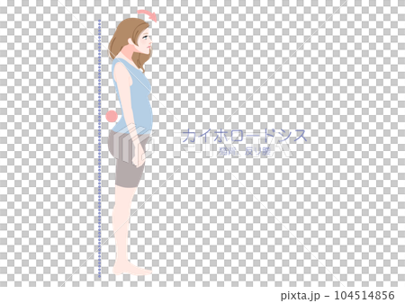 横から見たカイホロードシス姿勢の女性 104514856