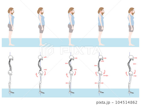 横から見た不良姿勢の女性セット 104514862