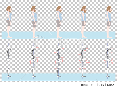 横から見た不良姿勢の女性セット 104514862